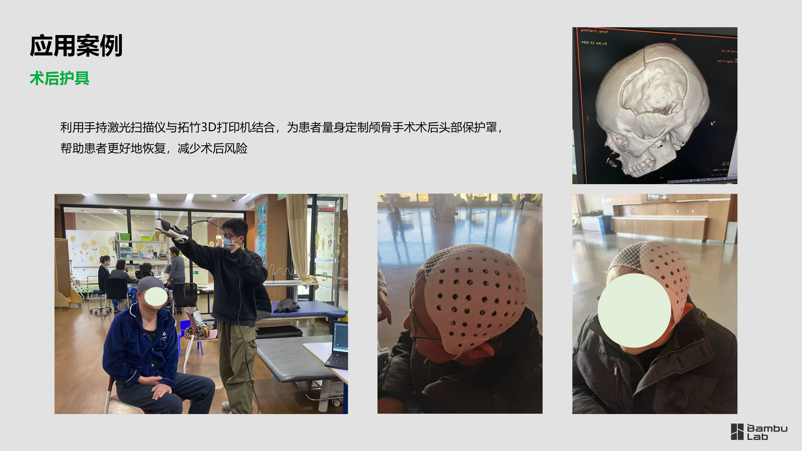 医疗-爱无疆社区康复团队应用案例2025.03.11_08.png