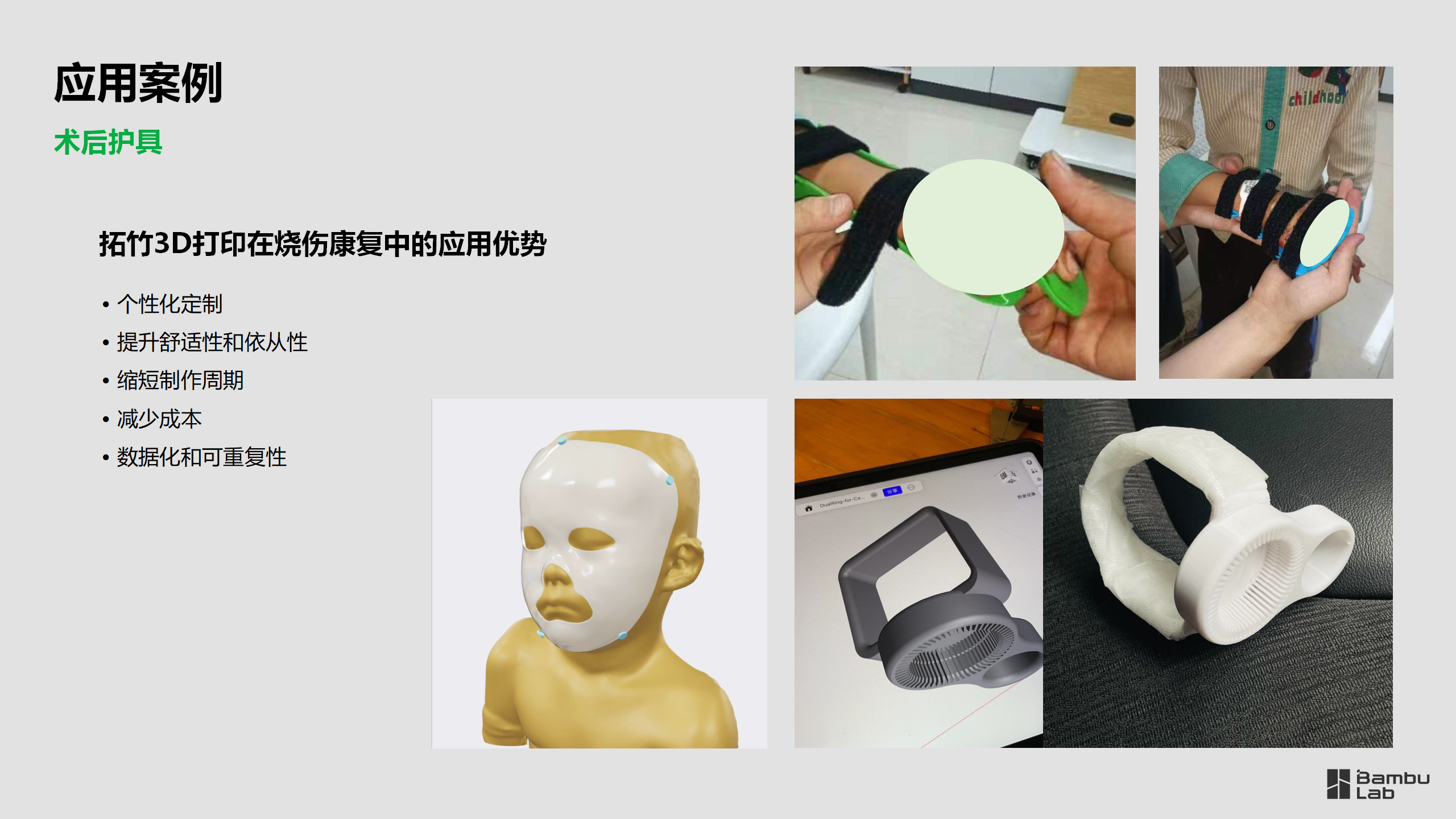 医疗-爱无疆社区康复团队应用案例2025.03.11_07.png