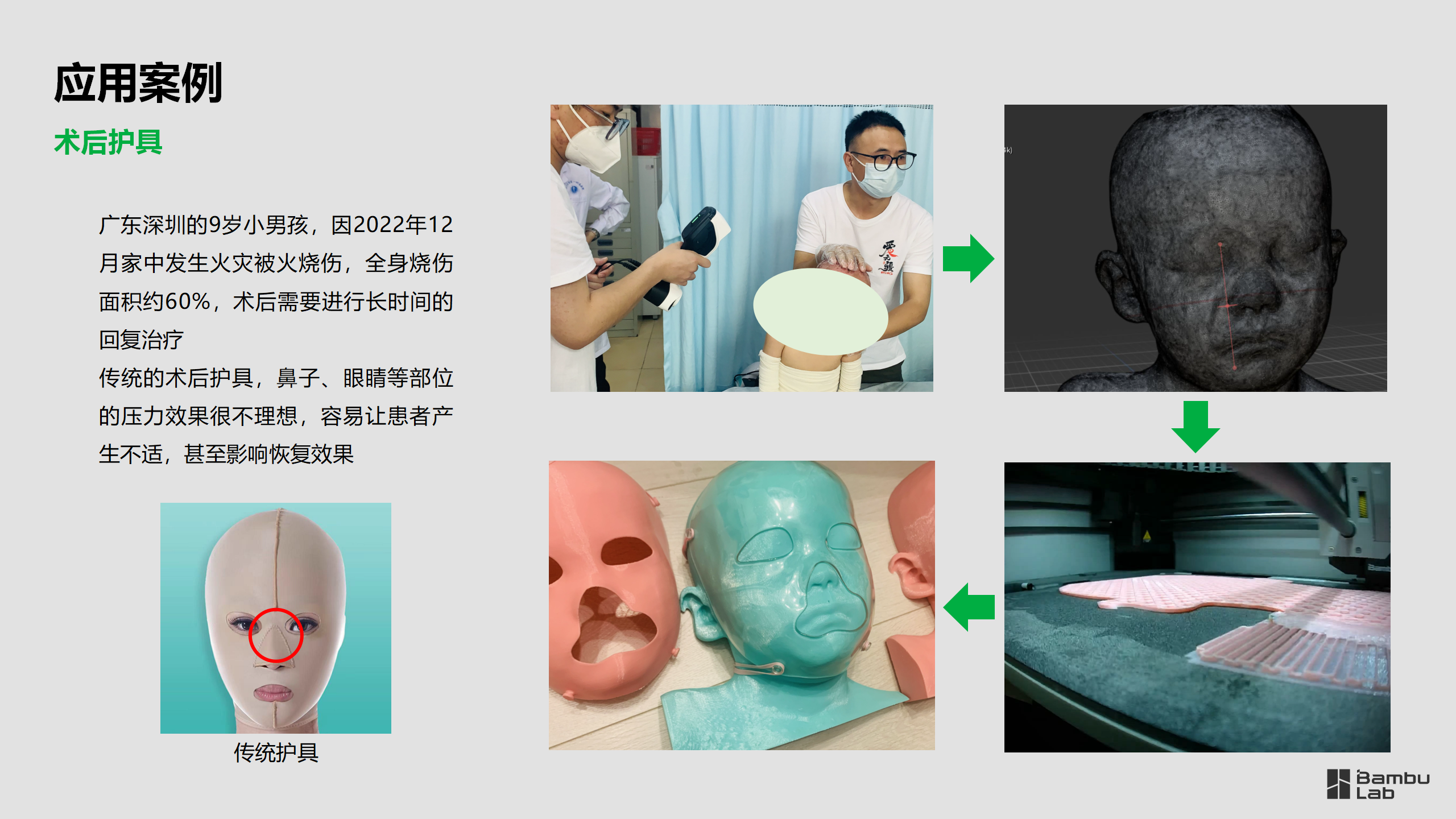 医疗-爱无疆社区康复团队应用案例2025.03.11_05.png